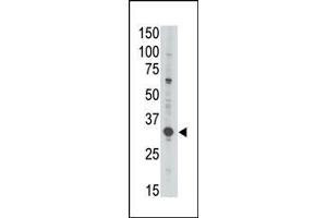 The anti-GEA3 (C-term) Antibody (ABIN390107 and ABIN2840619) is used in Western blot to detect GEA3 in Jurkat lysate. (MAGEA3 antibody  (C-Term))