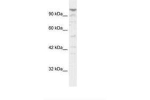 Image no. 1 for anti-La Ribonucleoprotein Domain Family, Member 1B (LARP1B) (AA 701-750) antibody (ABIN202965)