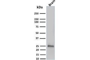 Western Blot Analysis of human brain tissue lysate using Pgp9. (UCHL1 antibody)