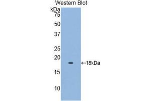 Western Blotting (WB) image for anti-Retinol Binding Protein 5, Cellular (RBP5) (AA 2-135) antibody (ABIN1860417) (Retinol Binding Protein 5 antibody  (AA 2-135))