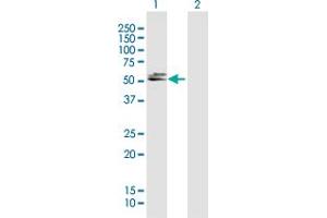 Western Blot analysis of DBT expression in transfected 293T cell line by DBT MaxPab polyclonal antibody. (DBT antibody  (AA 1-482))