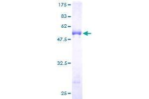 SLAP2 Protein (AA 1-261) (GST tag)
