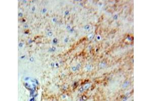 Used in DAB staining on fromalin fixed paraffin-embedded Brain tissue (SERPINB2 antibody  (AA 170-393))