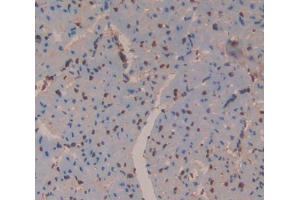 Used in DAB staining on fromalin fixed paraffin- embedded Kidney tissue (Antizyme Inhibitor 1 antibody  (AA 1-280))