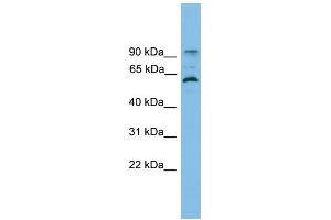 WB Suggested Anti-ANKRD5 Antibody Titration: 0. (ANKRD5 antibody  (N-Term))