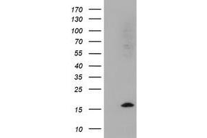 Image no. 1 for anti-Cystatin SA (CST2) antibody (ABIN1497758)