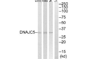 Western blot analysis of extracts from Jurkat, K562 and LOVOO cells, using DNAJC5 antibody. (DNAJC5 antibody)