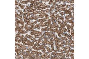 Immunohistochemical staining (Formalin-fixed paraffin-embedded sections) of human liver with CC2D1A polyclonal antibody  shows strong cytoplasmic positivity in hepatocytes at 1:50-1:200 dilution.