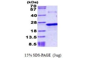 SDS-PAGE (SDS) image for Prepronociceptin (PNOC) (AA 20-176) protein (His tag) (ABIN5852945) (PNOC Protein (AA 20-176) (His tag))