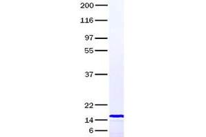 Validation with Western Blot (CXCL9 Protein)