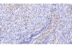 Detection of ALB in Human Kidney Tissue using Polyclonal Antibody to Albumin (ALB) (Albumin antibody)