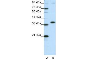 WB Suggested Anti-ZNF25 Antibody Titration:  1. (ZNF25 antibody  (C-Term))