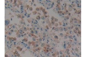 Immunohistochemistry (IHC) image for anti-Paxillin (PXN) (AA 201-461) antibody (ABIN7434188)