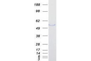 Fibulin 5 Protein (FBLN5) (Myc-DYKDDDDK Tag)