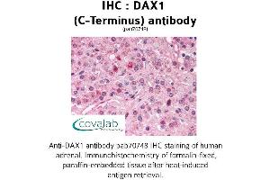 Image no. 1 for anti-Nuclear Receptor Subfamily 0, Group B, Member 1 (NR0B1) (C-Term) antibody (ABIN1733524) (NR0B1 antibody  (C-Term))