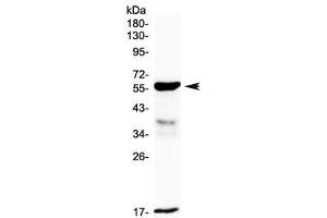 Western blot testing of rat small intestine lysate with GALNS antibody at 0.