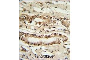 FOXP1 Antibody (C-term) (ABIN653806 and ABIN2843082) IHC analysis in formalin fixed and paraffin embedded lung tissue followed by peroxidase conjugation of the secondary antibody and DAB staining. (FOXP1 antibody  (C-Term))