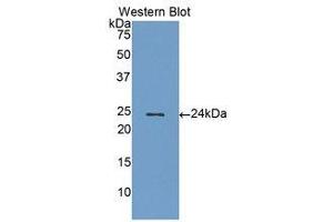 Western Blotting (WB) image for anti-Gremlin 1 (GREM1) (AA 26-184) antibody (ABIN1175536) (GREM1 antibody  (AA 26-184))