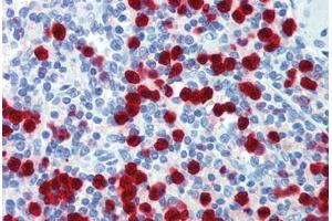 Human Spleen: Formalin-Fixed, Paraffin-Embedded (FFPE) (ZNF395 antibody  (C-Term))