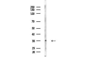 Western blot analysis of lysates from EC304 cells, using DIO2 Antibody at 1/1000 dilution.