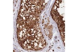 Immunohistochemical staining of human testis with CABP5 polyclonal antibody  shows strong cytoplasmic positivity in cells in seminiferus ducts. (CABP5 antibody)