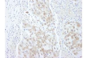 Immunohistochemistry (IHC) image for anti-Eukaryotic Translation Initiation Factor 4E Binding Protein 1 (EIF4EBP1) (C-Term) antibody (ABIN7448395) (eIF4EBP1 antibody  (C-Term))