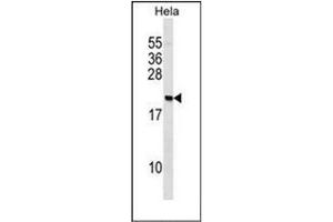 Western blot analysis of PAIP2 Antibody (N-term) in Hela cell line lysates (35ug/lane). (PAIP2 antibody  (N-Term))