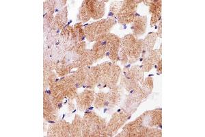 Immunohistochemical analysis of paraffin-embedded H. (SDHA antibody  (C-Term))