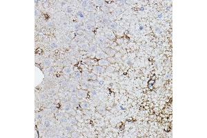 Immunohistochemistry of paraffin-embedded rat brain using CHAT Rabbit pAb (ABIN3016134, ABIN3016135, ABIN3016136 and ABIN6219569) at dilution of 1:50 (40x lens). (Choline Acetyltransferase antibody  (AA 331-630))