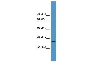 WB Suggested Anti-CD8A Antibody Titration: 0. (CD8 alpha antibody  (Middle Region))