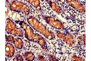 Immunohistochemistry of paraffin-embedded human small intestine tissue using ABIN7170381 at dilution of 1:100 (SNX27 antibody  (AA 458-497))