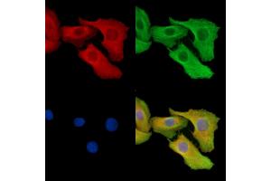 ABIN7095361 and ABIN7099418 staining Hela cells by IF/ICC. (ORMDL3 antibody)