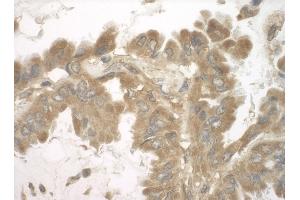 Immunohistochemistry (IHC) image for anti-Staphylococcal Nuclease Domain Containing Protein 1 (SND1) (AA 100-150) antibody (ABIN7453789)