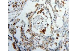 Used in DAB staining on fromalin fixed paraffin-embedded lung tissue (Vimentin antibody  (AA 2-466))