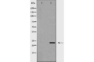 Western blot analysis of CD83 expression in HeLa cells,The lane on the left is treated with the antigen-specific peptide. (CD83 antibody  (Internal Region))