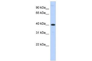 MPPE1 antibody used at 1 ug/ml to detect target protein. (MPPE1 antibody  (N-Term))