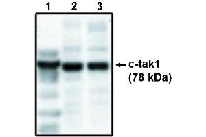 Western blot analysis using c-tak1 antibody . (TR4 antibody)
