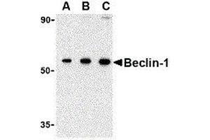 Western Blotting (WB) image for anti-Beclin 1, Autophagy Related (BECN1) (N-Term) antibody (ABIN2477609) (Beclin 1 antibody  (N-Term))