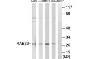 Western blot analysis of extracts from HeLa/MCF-7/HuvEc/A549 cells, using RAB20 Antibody. (RAB20 antibody  (AA 115-164))