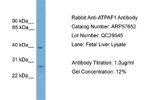 WB Suggested Anti-ATPAF1  Antibody Titration: 0. (ATPAF1 antibody  (Middle Region))