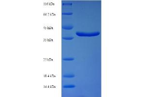 SDS-PAGE (SDS) image for 5,10-Methenyltetrahydrofolate Synthetase (5-Formyltetrahydrofolate Cyclo-Ligase) (MTHFS) (AA 2-203) protein (His-SUMO Tag) (ABIN5709975) (MTHFS Protein (AA 2-203) (His-SUMO Tag))