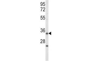 Western blot analysis of IGFBP2 antibody and Jurkat lysate (IGFBP2 antibody  (AA 277-305))