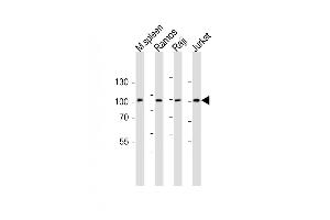 All lanes : Anti-BCL6 Antibody (Center) at 1:1000 dilution Lane 1: mouse spleen lysate Lane 2: Ramos whole cell lysate Lane 3: Raji whole cell lysate Lane 4: Jurkat whole cell lysate Lysates/proteins at 20 μg per lane. (BCL6 antibody  (AA 364-395))