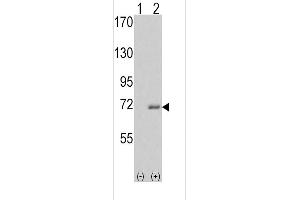 Western blot analysis of IRAK1 (arrow) using rabbit polyclonal IRAK Antibody (C-term) . (IRAK1 antibody  (C-Term))