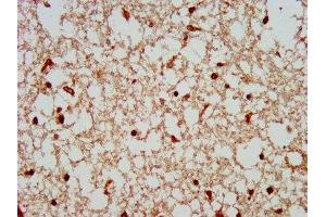IHC image of ABIN7148507 diluted at 1:300 and staining in paraffin-embedded human brain tissue performed on a Leica BondTM system. (COPS8 antibody  (AA 150-198))
