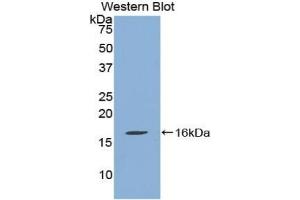 Detection of Recombinant QSOX1, Human using Polyclonal Antibody to Quiescin Q6 Sulfhydryl Oxidase 1 (QSOX1) (QSOX1 antibody  (AA 394-519))
