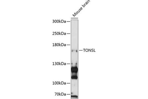 NFKBIL2 antibody  (AA 160-390)