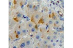 Used in DAB staining on fromalin fixed paraffin-embedded Liver tissue (LILRB3 antibody  (AA 410-631))