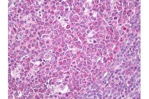 Anti-ADRM1 antibody IHC of human tonsil, germinal center. (ADRM1 antibody)
