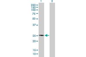 Western Blot analysis of PLA2G4D expression in transfected 293T cell line by PLA2G4D MaxPab polyclonal antibody. (PLA2G4D antibody  (AA 1-216))